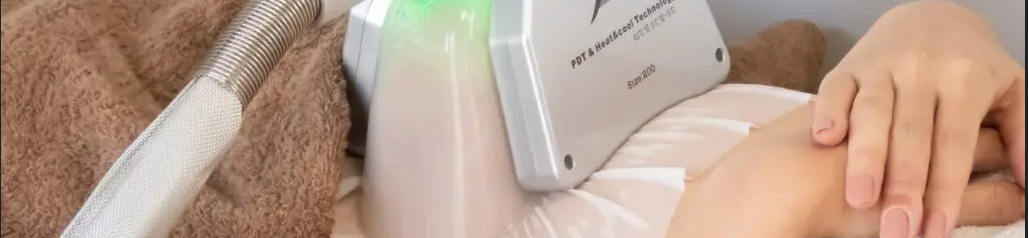 脂肪冷却痩身施術の様子